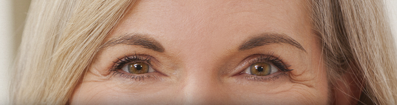 Blefaroplastia | Dr. Rodrigo Pimenta